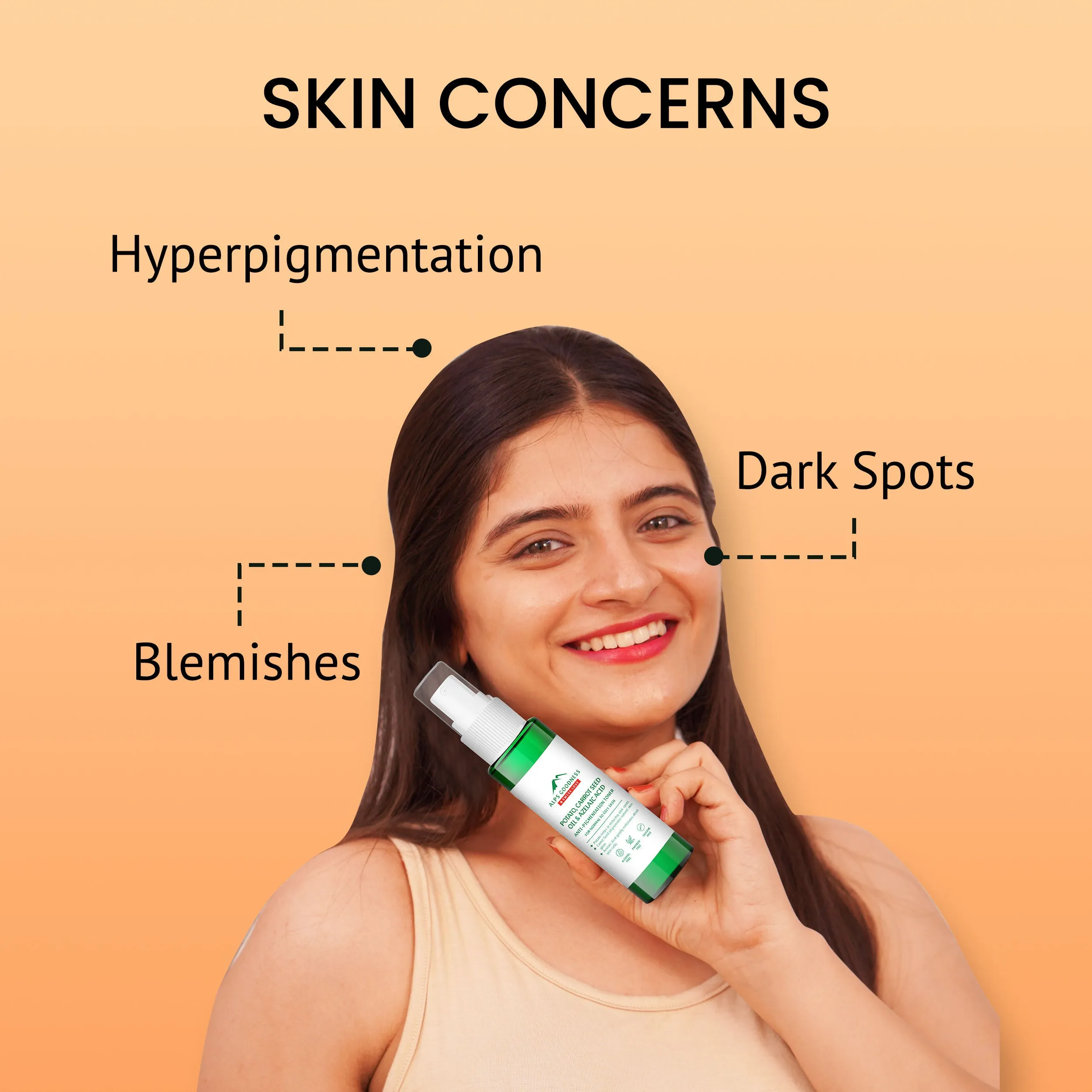 Alps Goodness Potato, Carrot Seed Oil & Azelaic Acid Anti-PIgmentation Toner (110 ml)| Anti-pigmentation Toner| No Silicones| No Sulphates| No Parabens| Mineral Oil Free| Vegan